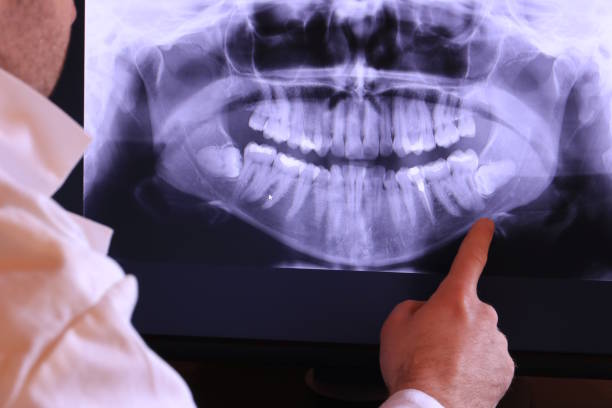 Best 24-Hour Emergency Dentist in Cleveland, NC