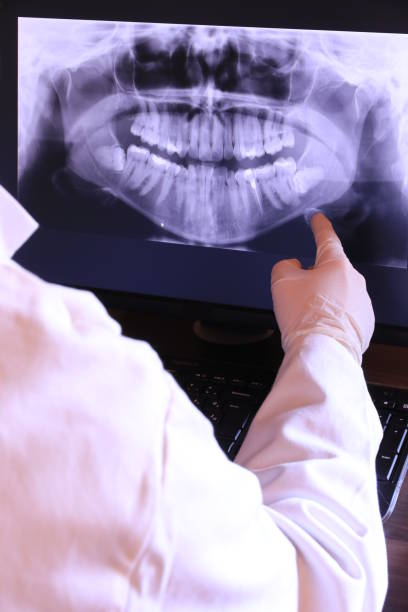 Best Emergency Root Canal Treatment in Cleveland, NC