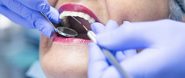 Best After-Hours Emergency Dentist in Cleveland, NC